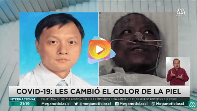 cambio de color covid19