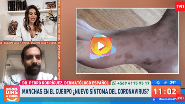 manchas covid19