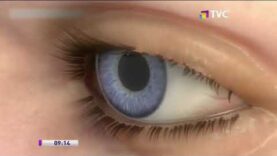 La Conjuntivitis podría ser un síntoma del COVID-19