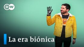 Prótesis inteligentes, ¿cómo funcionan?